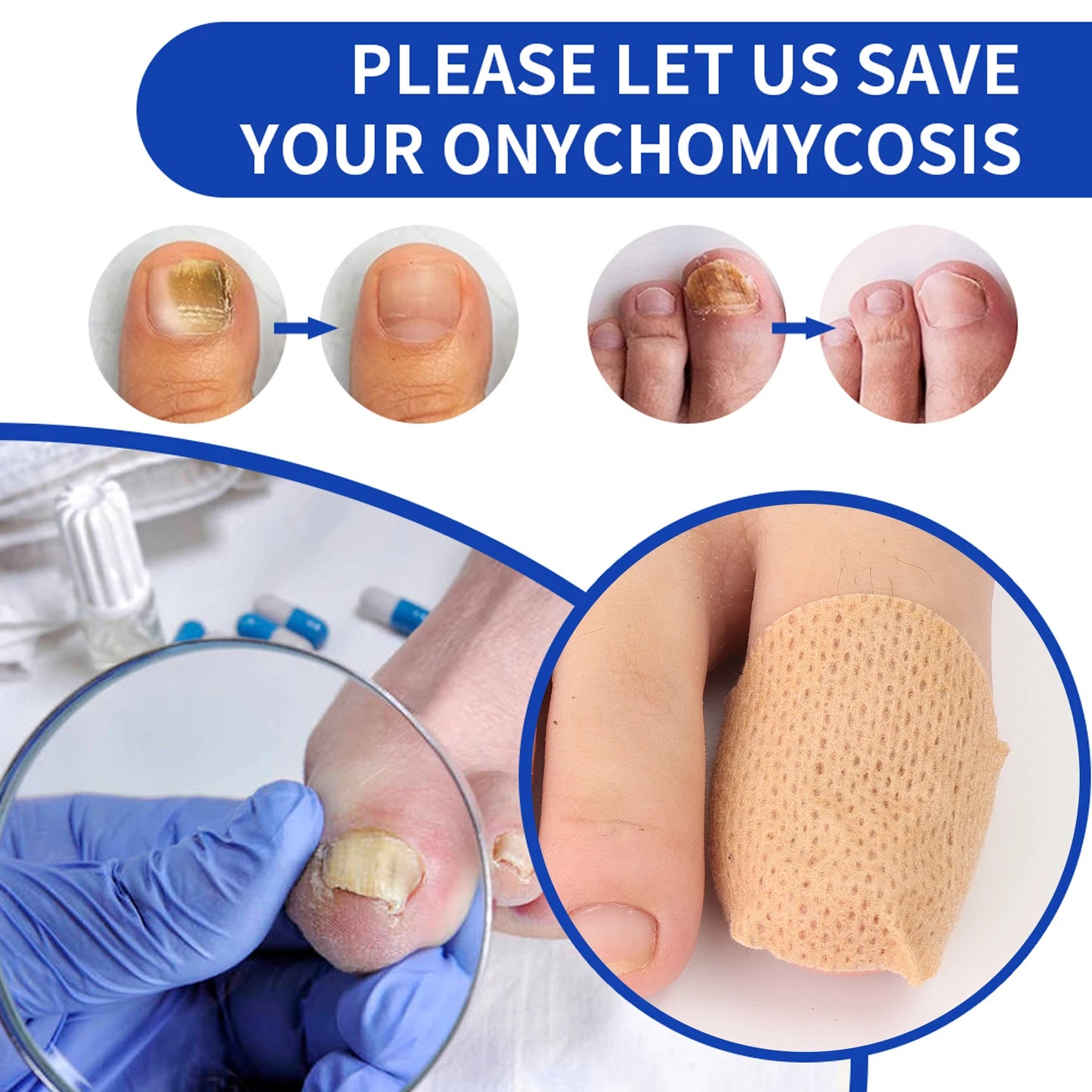 21pcs Nail Fungus Patch Waterproof Nail Repair Patch Ingrown Correction Sticker Damaged Nail Gray Care Patch Feet Care Tools