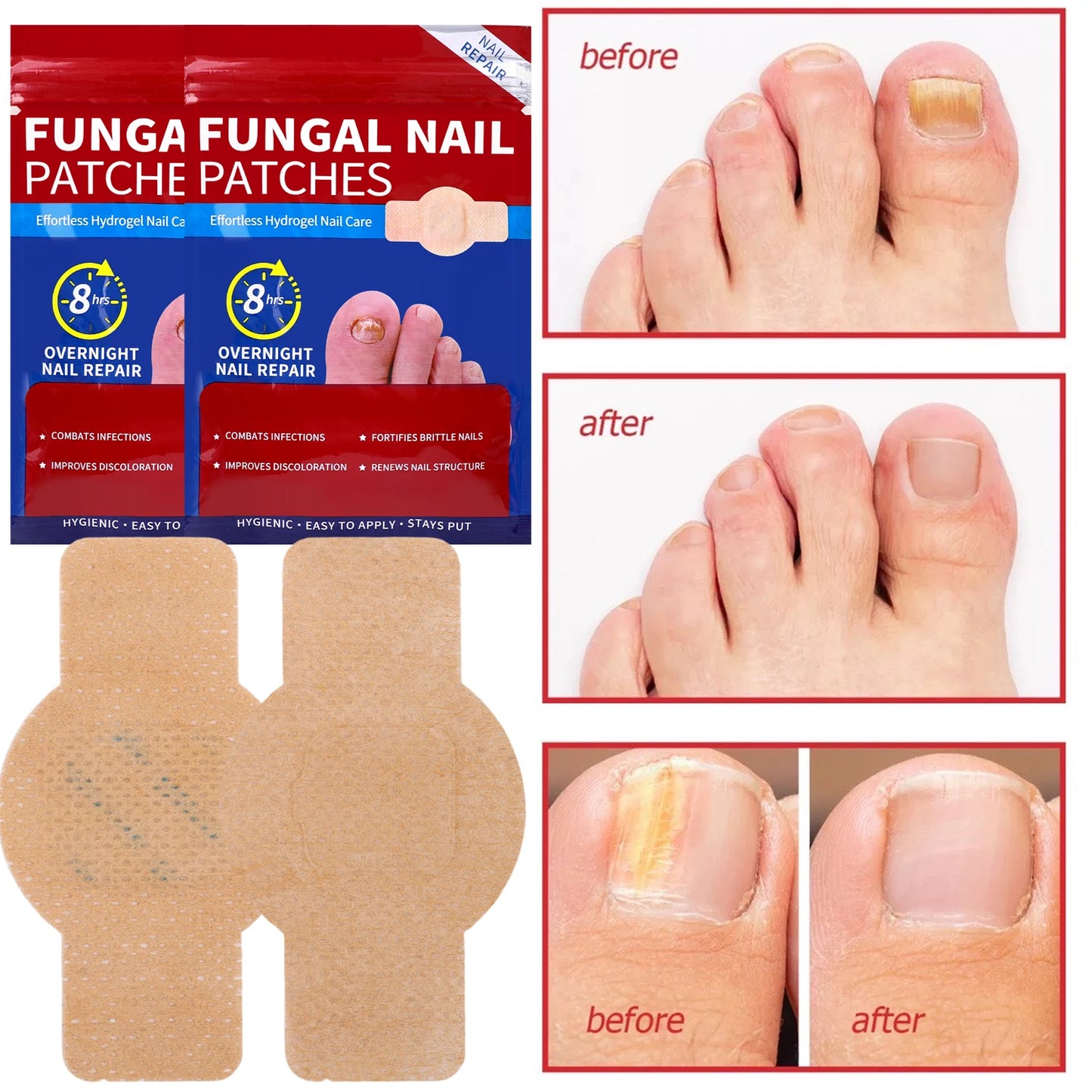 21pcs Nail Fungus Patch Waterproof Nail Repair Patch Ingrown Correction Sticker Damaged Nail Gray Care Patch Feet Care Tools